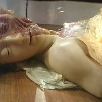 Museo delle Cere Anatomiche